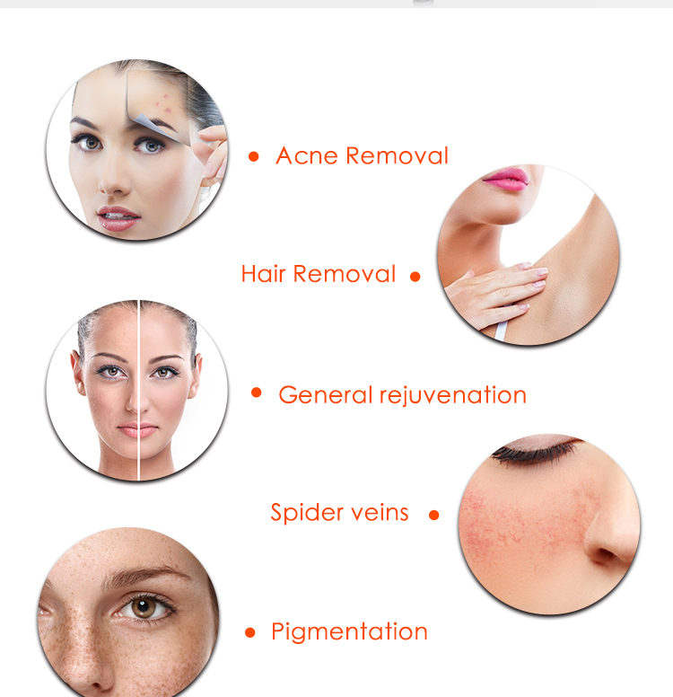 Multifunction Facial 2 In 1 IpL 808Nm Diode Laser Device Pigment Removal