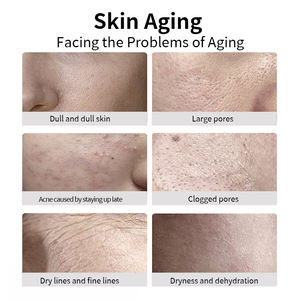 OEM محتوى إسفنجة ميكروكريستالات مسحوق مجفف بالتجميد ، عظم الأعشاب البحرية قناع ميكروكريستالات ، تجديد شباب الجلد ومكافحة حب الشباب - Product Image 6