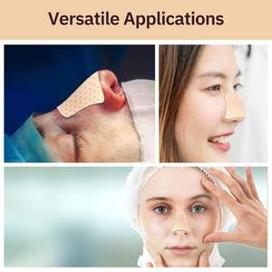 Na Neuscorrectie Hypothermische Lage Temperatuur Thermoplastisch Polymeer Materiaal Nasale Externe Neus Spalk - Product Image 4