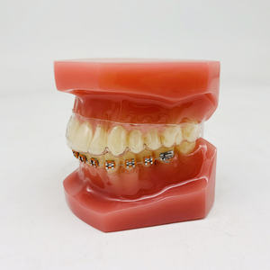 แบบจำลองทางทันตกรรมสำหรับการวิจัยทางทันตกรรมรูปแบบการรักษาทันตกรรมจัดฟัน - Product Image 5