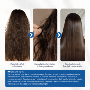 Shampoo antifongique pour le traitement du cuir chevelu, contre la dermatite séborrhéique, les pellicules, les démangeaisons et la sécheresse - Product Image 5