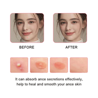 Patch de protection invisible ultra-fin sans couture à l'arbre à thé et à la Centella pour la détoxification et les soins de santé, à appliquer sous le maquillage