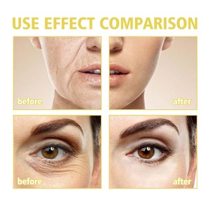 Soins de la peau cerise exfoliant fruité escargot blanc pour les rides lotion blanchissante massage venin de serpent <span class=keywords><strong>pop</strong></span> populaire orange crème pour le visage - Product Image 4