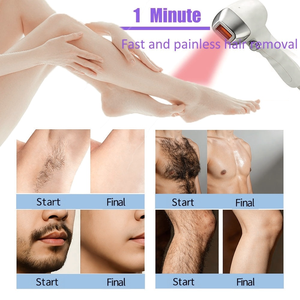 Appareil d'épilation à 3 longueurs d'onde avancées 755nm 808nm 1064nm, réduction des poils sur tout le corps pour usage professionnel en salon - Product Image 6