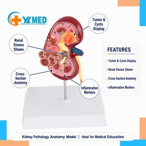 Modelo de anatomía del riñón humano para <span class=keywords><strong>urología</strong></span>: modelo especial de lesión renal - Product Image 1
