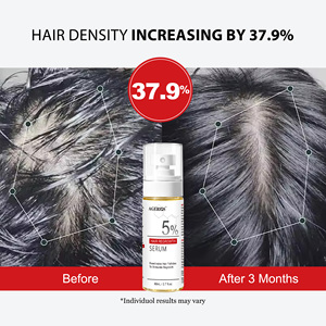 Spray para la Caída del Cabello para Hombres y Mujeres, <span class=keywords><strong>Alopecia</strong></span> Androgénica, Inhibidor de Androgenas al 5%, Bruma Capilar con Jengibre y Menta, Estimula el Crecimiento - Product Image 4