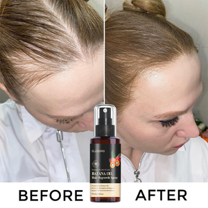 Vente en gros OEM Vegan <span class=keywords><strong>Spray</strong></span> d'huile de batana pour la repousse des <span class=keywords><strong>cheveux</strong></span> Huile anti-chute Essence de <span class=keywords><strong>cheveux</strong></span> <span class=keywords><strong>Spray</strong></span> pour la repousse des <span class=keywords><strong>cheveux</strong></span> pour femmes hommes - Product Image 2