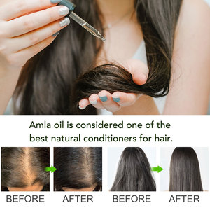 Aceite de Amla Orgánico Vegano de 60 ml para Reparación del Cabello Seco y Dañado, Aceite de Amla Puro de la India para el Crecimiento del Cabello, Venta al por Mayor - Product Image 2