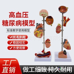 Modelo de hipertensión/presión arterial; Modelo de diabetes/visceras patológicas; Cerebro patológico; Presión ocular; Corazón; Riñones; - Product Image 1