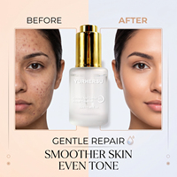 Sérum à l'acide mandélique en marque propre avec acide salicylique et niacinamide, essence exfoliante douce pour le visage, pour équilibrer la texture de la peau