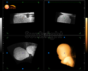 SUN-906A Dispositivo de Diagnóstico por Ultrasonido Doppler a Color Totalmente Digital, Máquina de Ecografía Cardiovascular - Product Image 4