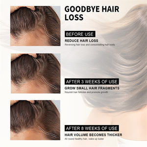 Sérum capillaire pour le soin du cuir chevelu à la lavande biologique 100% naturel, huile de traitement capillaire pour la croissance des cheveux pour femmes, étiquette privée personnalisée - Product Image 5