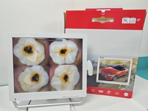 Équipement dentaire intelligent tout-en-un de haute qualité avec visualiseur <span class=keywords><strong>oral</strong></span> électrique, 2MP, mise au point 10-40mm, HDMI, application et support avec poignée - Product Image 6