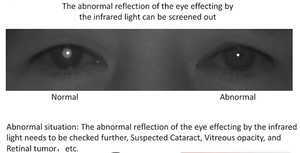 Portable Auto <strong>Refractometer</strong> for Eye Clinic Handheld Optical Diagnostic Equipment for Ophthalmology Optometry <strong>Medical</strong> Instrument - Product Image 6