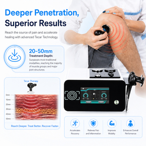 Máquina de Fisioterapia Tecar de Diatermia Capacitiva y Resistiva de 448khz con Certificación CE para Recuperación de Tejidos Profundos - Product Image 2
