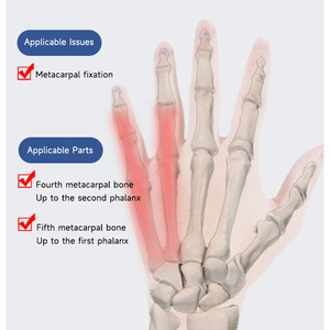 Revalidatietherapie Levert Aluminium Plaatbreuk Polsondersteuning Vierde Vijfde Middenhandsfixatiebrace Met Klittenband - Product Image 6