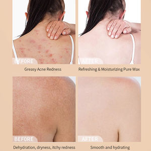 Jabón líquido para limpieza <span class=keywords><strong>de</strong></span> ácaros <span class=keywords><strong>de</strong></span> <span class=keywords><strong>azufre</strong></span> para adultos, <span class=keywords><strong>aceite</strong></span> <span class=keywords><strong>de</strong></span> <span class=keywords><strong>oliva</strong></span> a base <span class=keywords><strong>de</strong></span> hierbas, blanqueamiento adelgazante, antiséptico, características antiacné para el cuidado <span class=keywords><strong>de</strong></span> la piel - Product Image 2