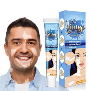 20g d'extrait de plantes pommade pour le vitiligo crème de traitement de la teigne élimination des <span class=keywords><strong>taches</strong></span> <span class=keywords><strong>blanches</strong></span> <span class=keywords><strong>peau</strong></span> tache blanche leucoplasie <span class=keywords><strong>maladie</strong></span> - Product Image 1