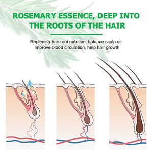 <span class=keywords><strong>Huile</strong></span> capillaire à base <span class=keywords><strong>de</strong></span> plantes transfrontalière au romarin, prévient la chute et la casse des cheveux, <span class=keywords><strong>huile</strong></span> <span class=keywords><strong>de</strong></span> massage du cuir chevelu pour cheveux épais, soin <span class=keywords><strong>de</strong></span> la ligne des cheveux, régularise le croissance. - Product Image 4