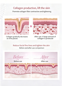 เครื่องดูแลผิวแบบฟองออกซิเจน 10-in-1 พร้อมหัววัดหลายแบบ ฟังก์ชั่นทำความสะอาดรูขุมขนและกระตุ้นคอลลาเจนเพื่อการฟื้นฟูผิวหน้า - Product Image 5