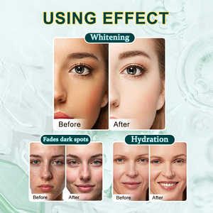 سيروم تفتيح البشرة بحمض الكوجيك + النياسيناميد مع أمبولات بودرة - خلاصة كورية مضادة للشيخوخة للوجه، يُفعل بالخلط، تركيبة نقية - Product Image 5