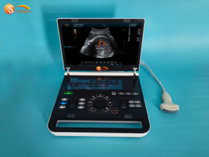Échographe Doppler Couleur Numérique Portable 3D 4D avec Système et Accessoires – <span class=keywords><strong>Prix</strong></span> - Product Image 3