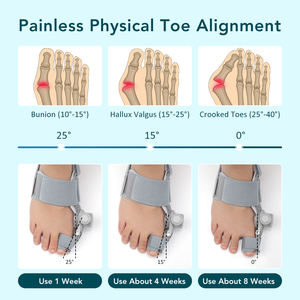 Séparateur de gros orteils pas cher Attelle d'oignon Lisseur Soulagement de la douleur des pieds Correction de l'hallux valgus Séparateurs d'orteils d'oignon - Product Image 2
