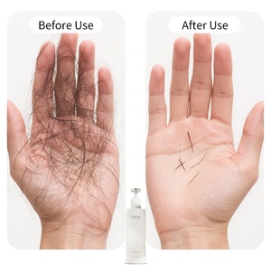 Vente en gros 250g de shampooing bio <span class=keywords><strong>anti</strong></span>-<span class=keywords><strong>chute</strong></span> de cheveux avec logo personnalisé shampooing <span class=keywords><strong>efficace</strong></span> pour le contrôle de la <span class=keywords><strong>chute</strong></span> des cheveux de marque privée - Product Image 5