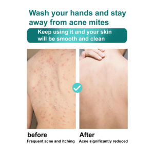 Gel douche exfoliant ROUSHUN au riz pur et au collagène 10X 1000ml - Product Image 4