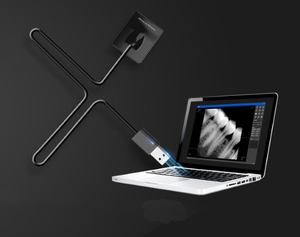 Le cliniche dentali vendono sensori Xpect di grandi dimensioni/tecnologia di Imaging/AI di un secondo. - Product Image 5