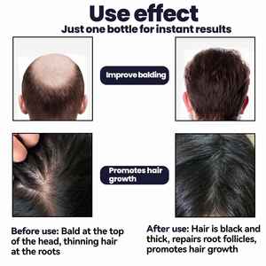 Suero Capilar OUHOE OEM de Marca Privada con Extracto de Plantas, Anti-Puntas Abiertas, Suavizante, Engrosador y Fortalecedor del Cabello, Estimulante del Crecimiento y Anticaída - Product Image 6