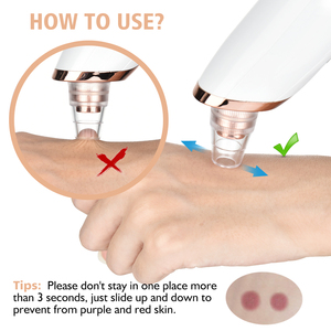 Cheap Hand Held Plastic Electric Vacuum Blackhead Extractor with 3-Level Strong Suction and Charging for Face <strong>Black</strong> <strong>Head</strong> <strong>Removal</strong> - Product Image 3