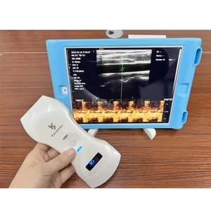 Tıbbi ultrason kablosuz 3 in 1 el 192 elemanları Vet ultrason makinesi dışbükey ve doğrusal kablosuz ultrason