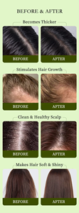 Shampooing et revitalisant pour la croissance des cheveux à base de plantes réparation au gingembre botanique traitement Anti-perte de cheveux huile plus épaisse ensemble de soins pour la repousse des cheveux - Product Image 6