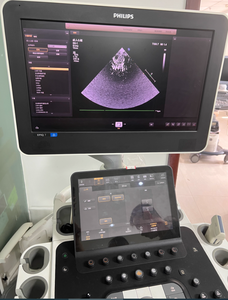 Fourniture et réparation de la machine à ultrasons EPIQ 5 ,EPIQ 7 Dépannage des problèmes d'imagerie - Product Image 4