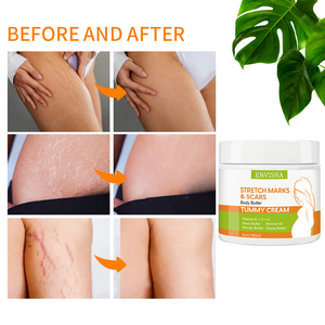 Crème efficace pour éliminer les vergetures et les cicatrices après la grossesse, crème anti-vergetures pour femmes - Product Image 2