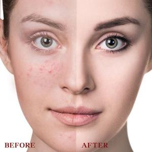 Control de aceite Cosmético Cubierta mate Manchas Círculos oscuros Maquillaje impermeable orgánico vegano de larga duración Cobertura completa Corrector líquido - Product Image 4