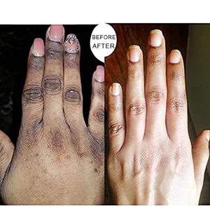 BLIW-Corrector de manchas oscuras personalizado, crema blanqueadora de piel brillante, crema para nudillos oscuros, venta al por mayor - Product Image 5