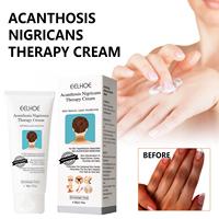 Acanthosis Nigricans Crème éclaircissante pour le corps au rétinol Vitamine C Ingrédients hydratants pour le visage, les bras, les genoux et les articulations