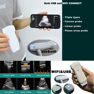 Usb Wifi Types Draagbare Kleur Doppler Draadloze Ultrasound Machine/Probe Convex + Lineaire + Cardiale