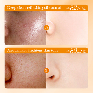 <span class=keywords><strong>BIOAQUA</strong></span> Papaya vitamina C hidratante exfoliante blanqueador limpieza y dragado de poros limpiador Facial - Product Image 5