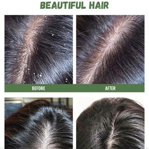 Champú de Árbol de Té Natural y Orgánico de 500 ml al por Mayor para el Cuidado del Cabello, Control de Grasa, Nutritivo, Suavizante y Anticaspa - Product Image 6