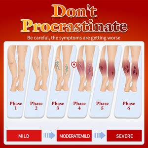 Salep Varises untuk Meredakan Nyeri Kaki dan Mengobati Vaskulitis - Product Image 4