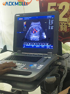 Ecografo الموجات فوق الصوتية الرقمية للقلب بالألوان دوبلر ثلاثي الأبعاد 4d صدى طبي للإنسان - Product Image 4