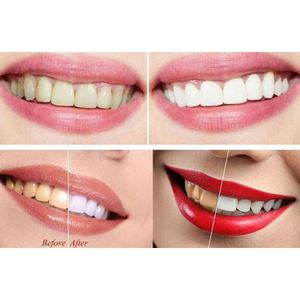 Nuevos aparatos de simulación de dientes, carillas sonrientes, <span class=keywords><strong>dentaduras</strong></span> postizas cosméticas, cubierta de diente falso superior e inferior, herramienta perfecta - Product Image 5