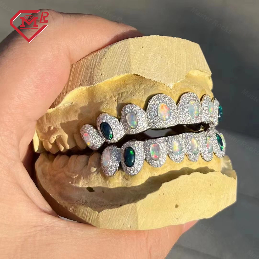 Opale personnalisée par dent