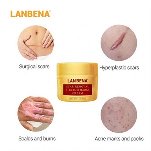 marcas eliminación crema embarazo cicatriz tratamiento de reparación Crema de Cara de piel suave cuerpo Dropshipping Exclusivo - Product Image 4