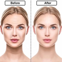 Vente chaude femmes Silicone Anti-rides réutilisable patchs pour les yeux accessoire intime respectueux de la peau réduire les rides fines froncement de sourcils