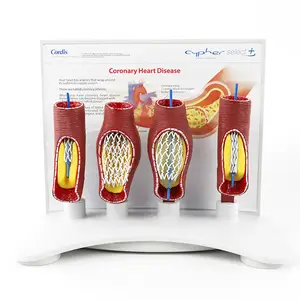 Vascular stent model human vascular model Medical Human Teaching Pathological Vascular anatomy model