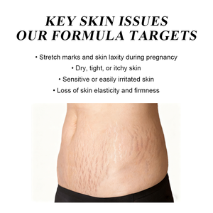 Crème réparatrice pour le corps au beurre de karité biologique, marque privée OEM, pour les vergetures et les cicatrices de <span class=keywords><strong>grossesse</strong></span> - Product Image 3